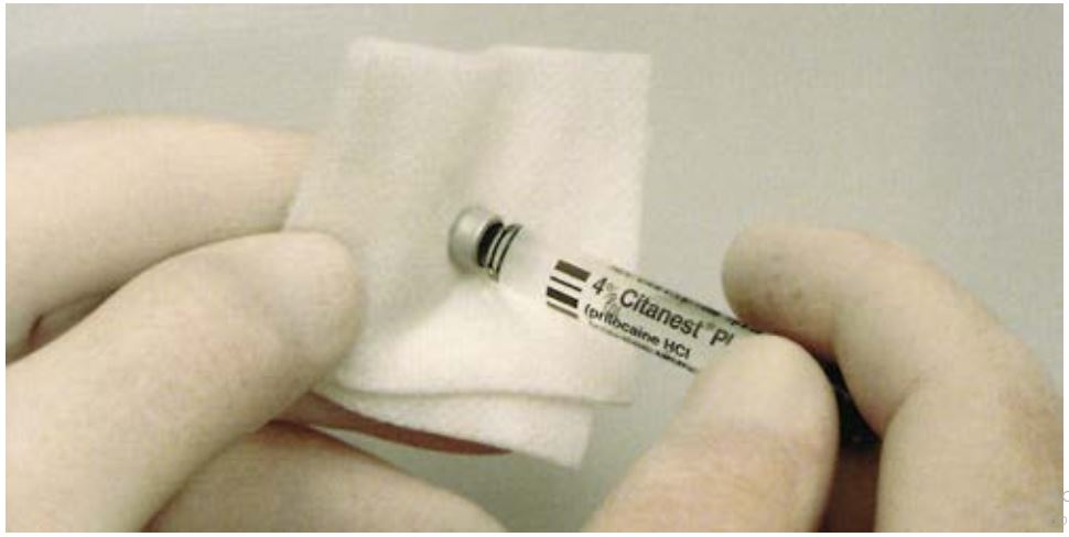 Cách lau ống thuốc tê nha khoa bằng cồn.