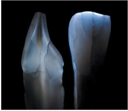 Hiệu ứng opalescent màu xanh dương do sự phản xạ và sự truyền ánh sáng có bước sóng xanh.