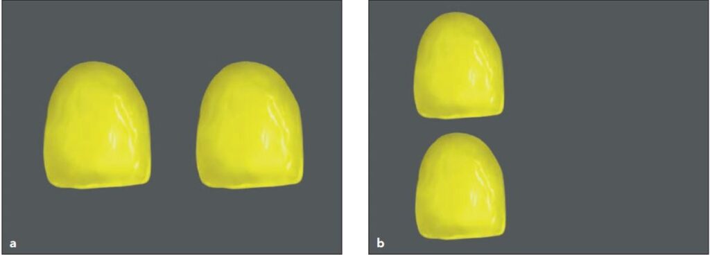 (a) Sự khác biệt khả năng nhận thức màu giữa 2 mắt. Khi 2 vật thể có cùng hình dạng và màu sắc được đặt cạnh nhau và trông chúng có vẻ hơi khác nhau, chẳng hạn như, 1 cái này trông có vẻ sáng hơn cái kia. (b) Nếu 2 vật thể đặt gần nhau theo chiều đứng thì hiện tượng đó không xảy ra.