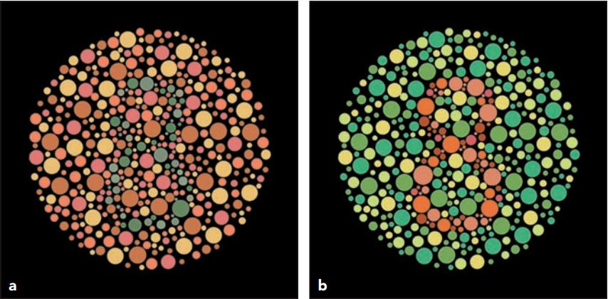 Test khiếm khuyết màu khi so màu răng. (a) Test độ nhạy với màu xanh lá và màu vàng để phát hiện số 8. (b) Test ngược, số 8 dễ thấy hơn vì các tế bào nón nhạy với màu tím-đỏ.