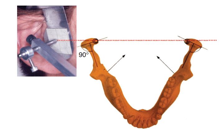 Bản ghi trục bản lề cho thấy lồi cầu có thể qua quanh một trục cố định.
