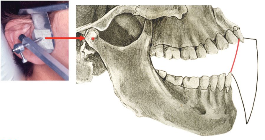 Bản ghi vận động của hàm dưới, khi vận động trong giới hạn bản lề (đường màu đỏ) thì lồi cầu vẫn giữ nguyên vị trí ở TQTT (chấm sao màu đỏ).