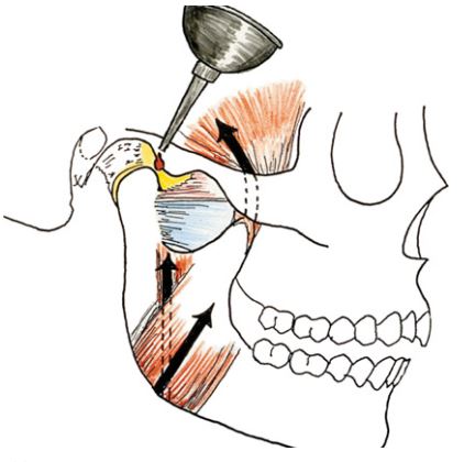 chất hoạt dịch