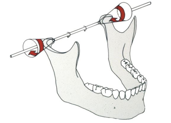 Khi ở tương quan trung tâm, chỉ có cực trong của lồi cầu là quay quanh 1 trục cố định.