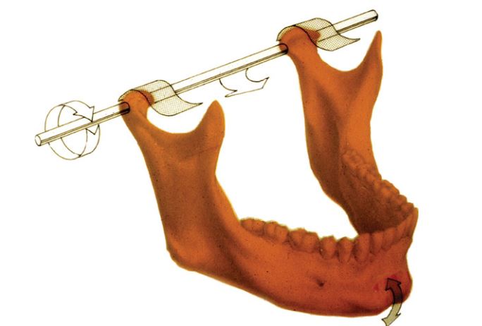 Lồi cầu có thể xoay quanh một trục cố định khi ở tương quan trung tâm.