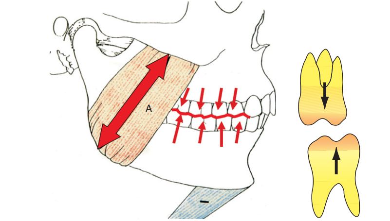 Răng có khunh hướng mọc lên liên tục cho đến khi chạm răng đối. Điểm chạm này có liên quan trực tiếp đến chiều dài cơ khi co (A).